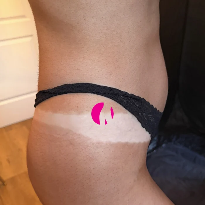 Spray-Tan-Ergebnis mit klarer Bräunungslinie an der Hüfte